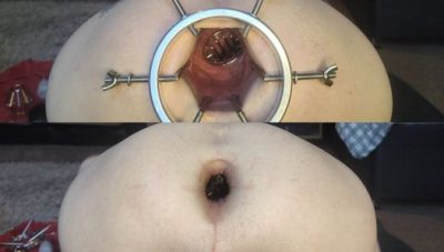 Both holes stretched ft David Anderson