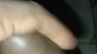 A milky discharge